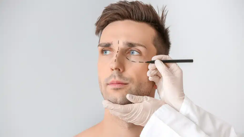 Man with facial markings for plastic surgery consultation, representing medical SEO and on-page SEO services to attract premium cosmetic surgery clients.